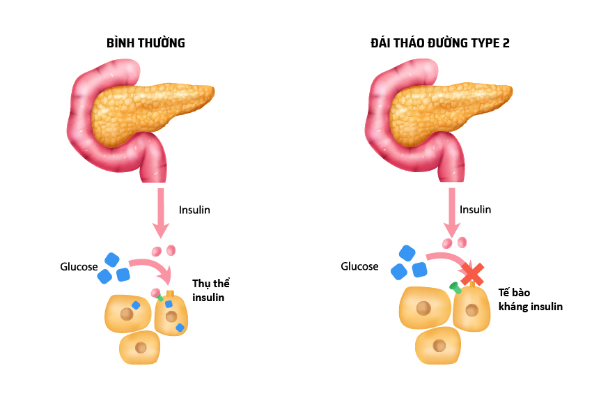 khang-insulin